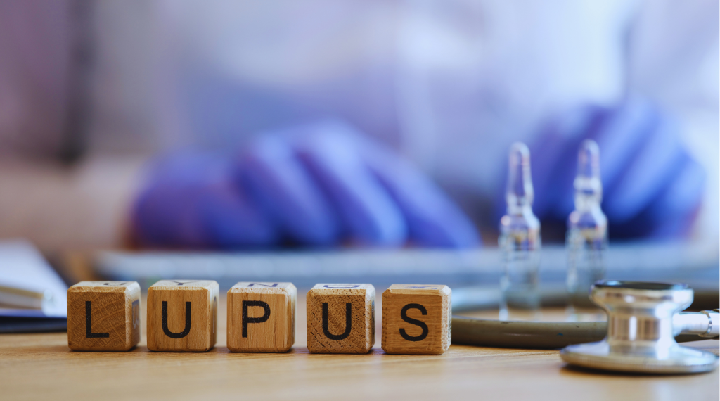 What is Lupus? Symptoms and Treatment Options